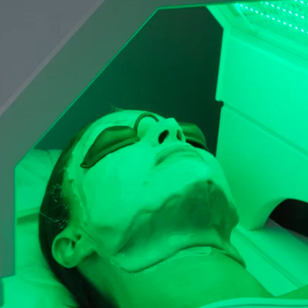 skinstorm 6