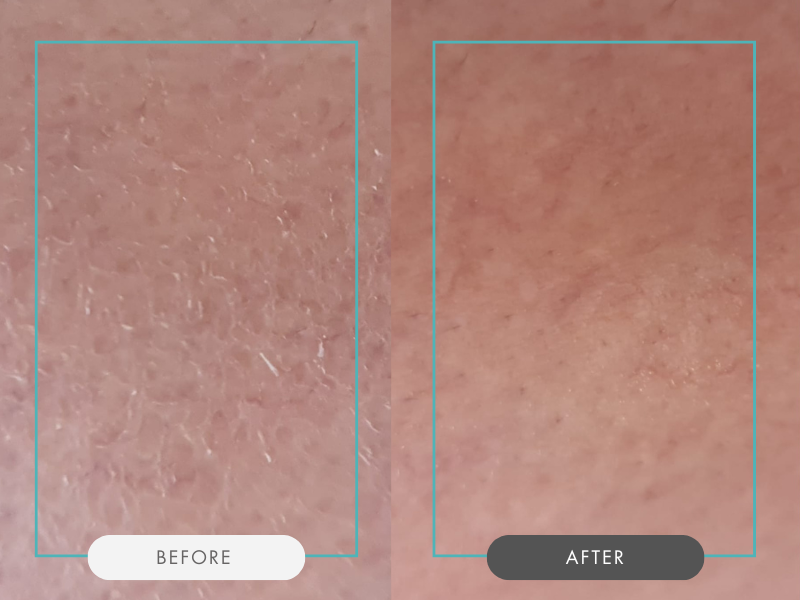 Prime & Peel Before and After