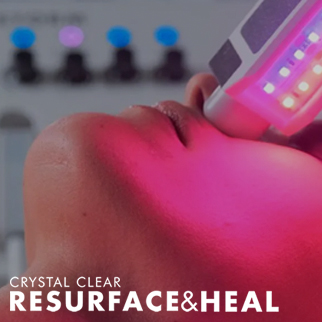 Resurface & Heal Spare Parts